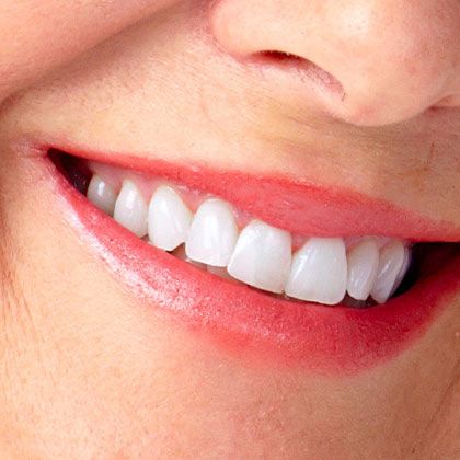 Healthier Gums
